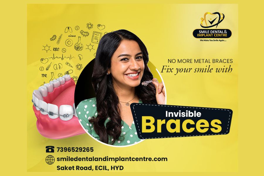 Smile Dental and Implant Centre shared the benefits of Invisible Braces over the Traditional Braces Treatment in a recently held Press Conference   